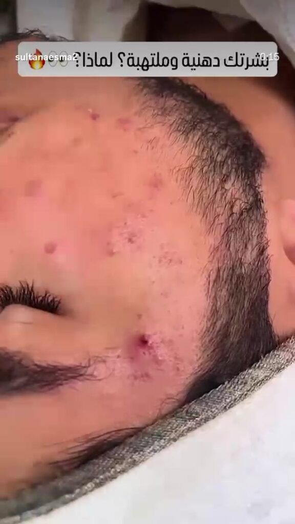 Cilt bakım ritüeli